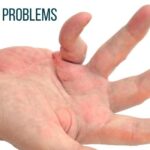 Understanding Loguytren Problems: Causes, Symptoms, and Treatment Options