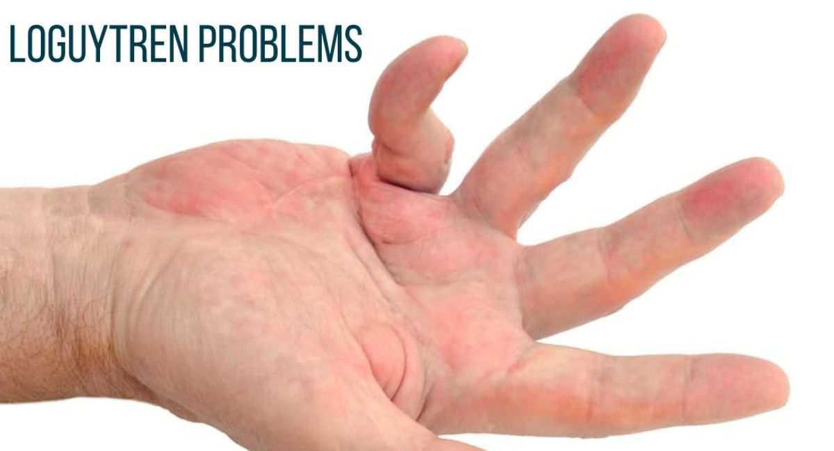 Understanding Loguytren Problems: Causes, Symptoms, and Treatment Options